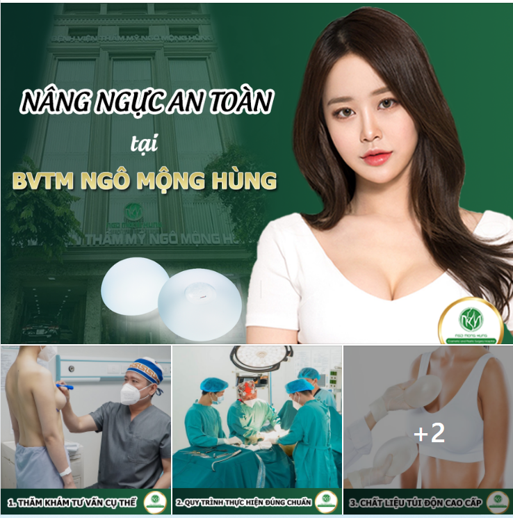 NÂNG NGỰC AN TOÀN TẠI BVTM NGÔ MỘNG HÙNG