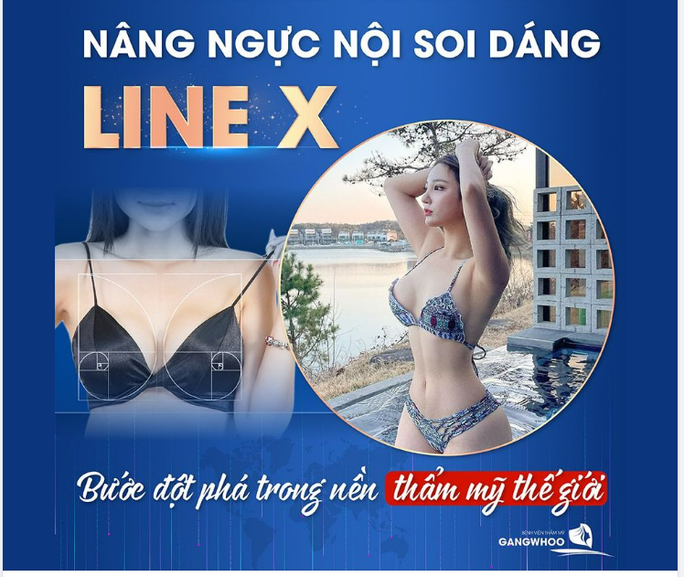 NÂNG NGỰC LINE X - BƯỚC ĐỘT PHÁ TRONG NỀN CÔNG NGHỆP THẨM MỸ THẾ GIỚI