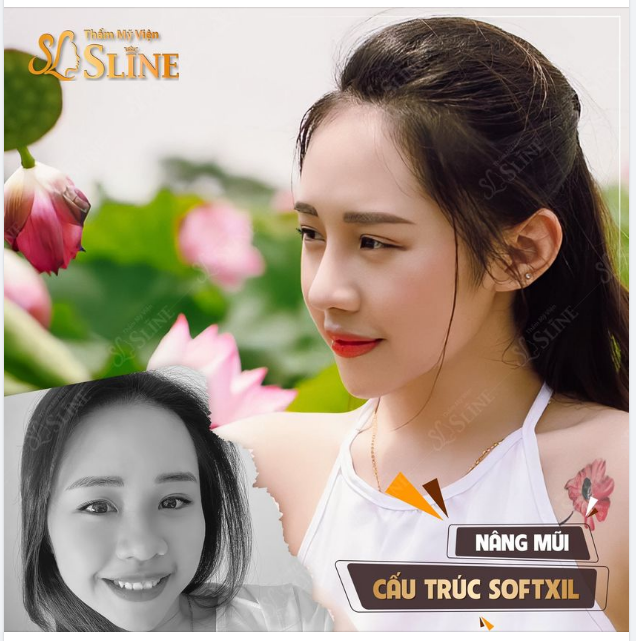 Nâng nhẹ cái mũi mà khuôn mặt của bạn ấy đã đẹp như thế này rồi.