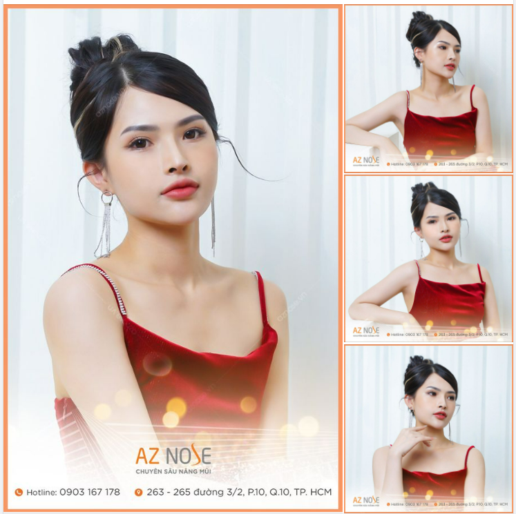 Nàng Streamer đẹp sang chảnh sau 5 tháng nâng mũi