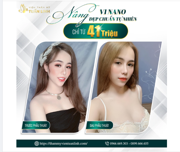 NÂNG V1 - ĐẸP TỰ NHIÊN - CHỈ 41 TRIỆU - TRẢ GÓP LÃI 0%