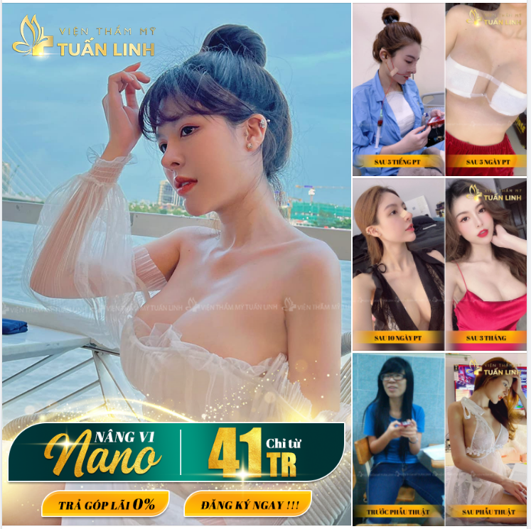 NÂNG VÒNG 1 - NÂNG TẦM NHAN SẮC