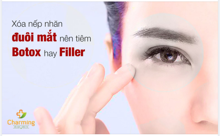 NÊN TIÊM BOTOX HAY FILLER ĐỂ LOẠI BỎ NẾP NHĂN ĐUÔI MẮT