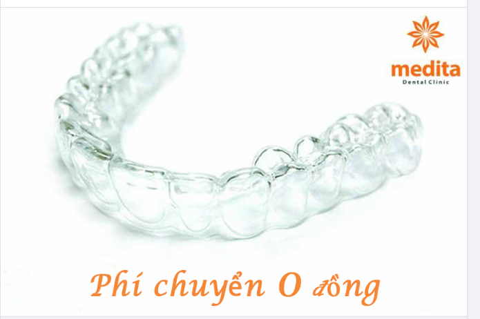 NẾU ĐANG ĐEO MÁNG NIỀNG NHƯNG TÔI CẦN RA NƯỚC NGOÀI THÌ PHẢI LÀM SAO?