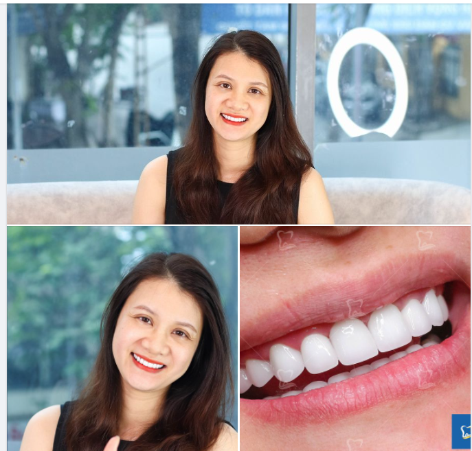 Nếu đôi mắt là cửa sổ tâm hồn thì nụ cười chính là khởi nguồn của sự hạnh phúc