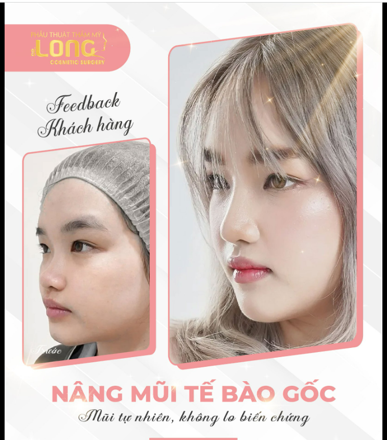 NGÀY TRƯỚC AI CŨNG CHÊ - GIỜ THÌ AI CŨNG U MÊ