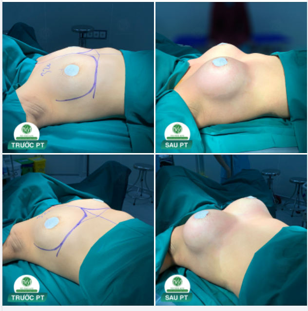 NGỰC ĐẸP CHO NGÀY LỄ 30/04