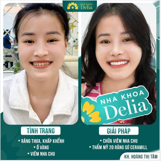 Nha Khoa Delia - Kiến Tạo Nụ Cười Rạng Rỡ Từ Sự An Toàn Tuyệt Đối