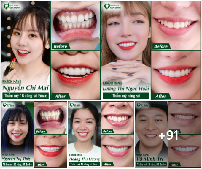 NHA KHOA GIA ĐÌNH: "THẤY KHÁCH HÀNG CƯỜI TƯƠI LÀ NIỀM VUI LẠI ẬP ĐẾN"