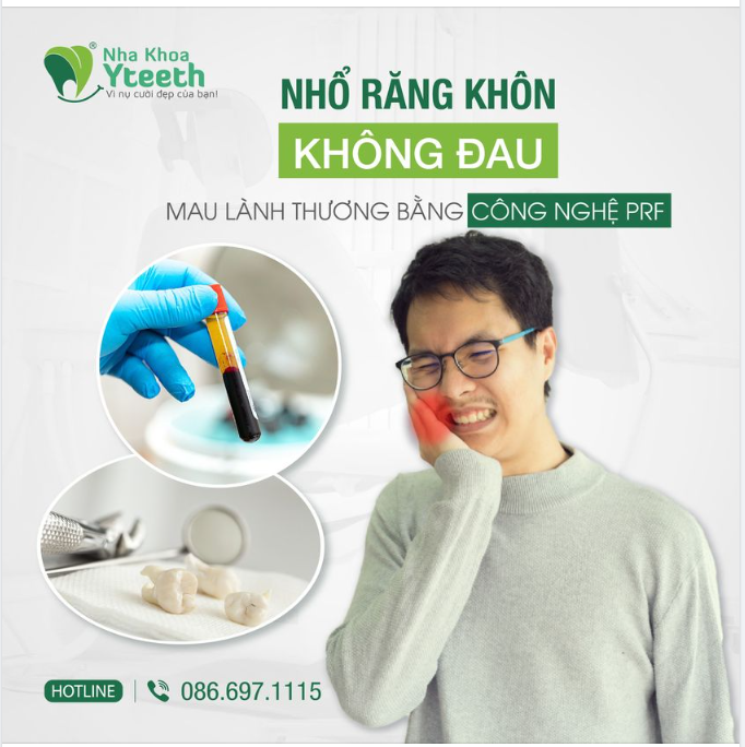 Nha khoa Thẩm mỹ Yteeth đã "xử lý" thành công hàng ngàn ca răng khôn khó, mọc lệch hay mọc ngầm.