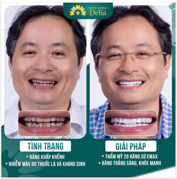 Nha khoa uy tín, thẩm mỹ răng an toàn - Là những tiêu chí hàng đầu của các đấng mày râu lựa chọn thẩm mỹ răng sứ.