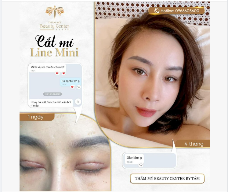 Nhà không có gì ngoài Feedback CẮT MÍ LINE MINI siêu đẹp