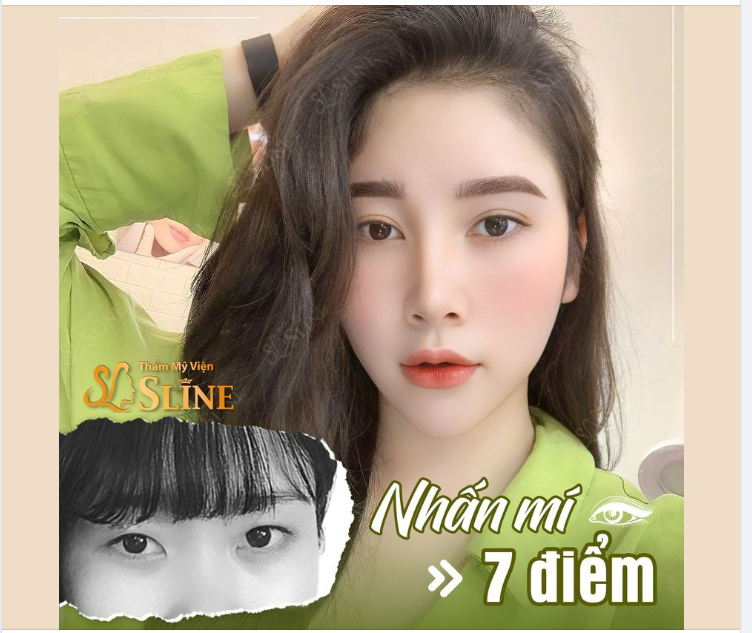NHẤN MÍ 7 ĐIỂM