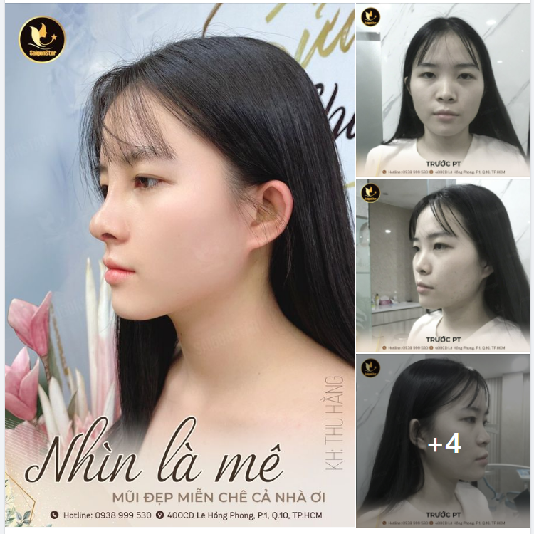 NHÌN LÀ MÊ - MŨI ĐẸP MIỄN CHÊ CẢ NHÀ ƠI