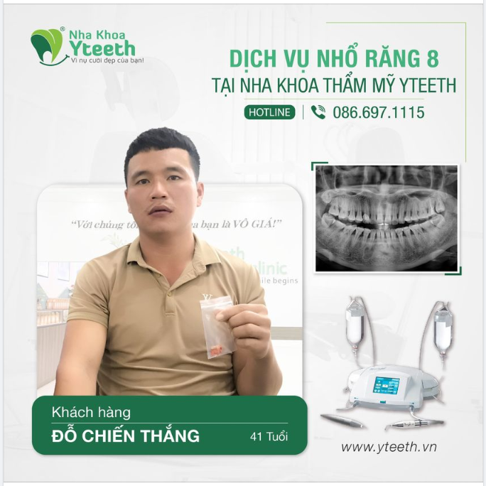 NHỔ RĂNG KHÔN AN TOÀN LÀ NHƯ THẾ NÀO?
