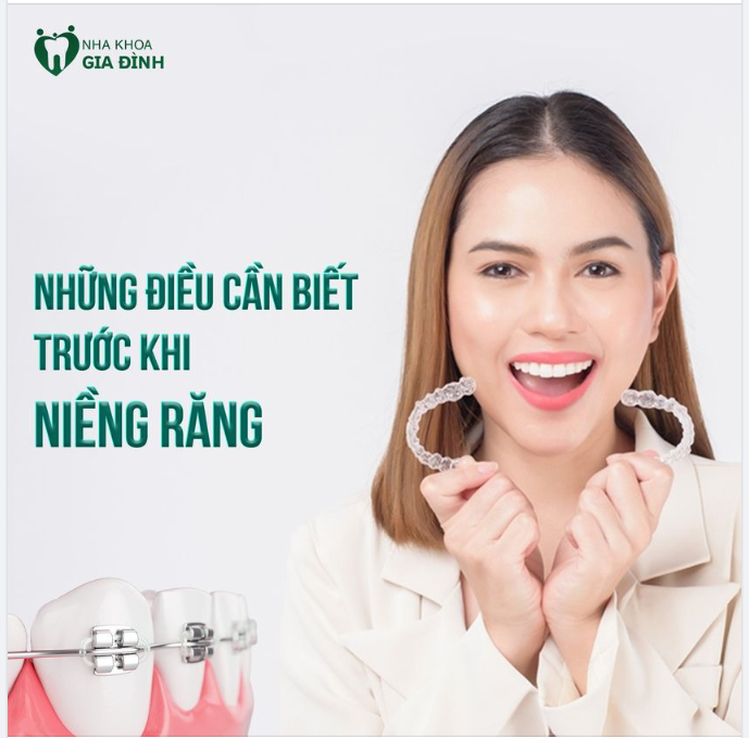 NHỮNG ĐIỀU BẠN CẦN BIẾT TRƯỚC KHI NIỀNG RĂNG