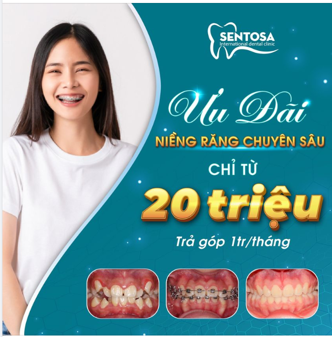 NIỀNG RĂNG CHUYÊN SÂU