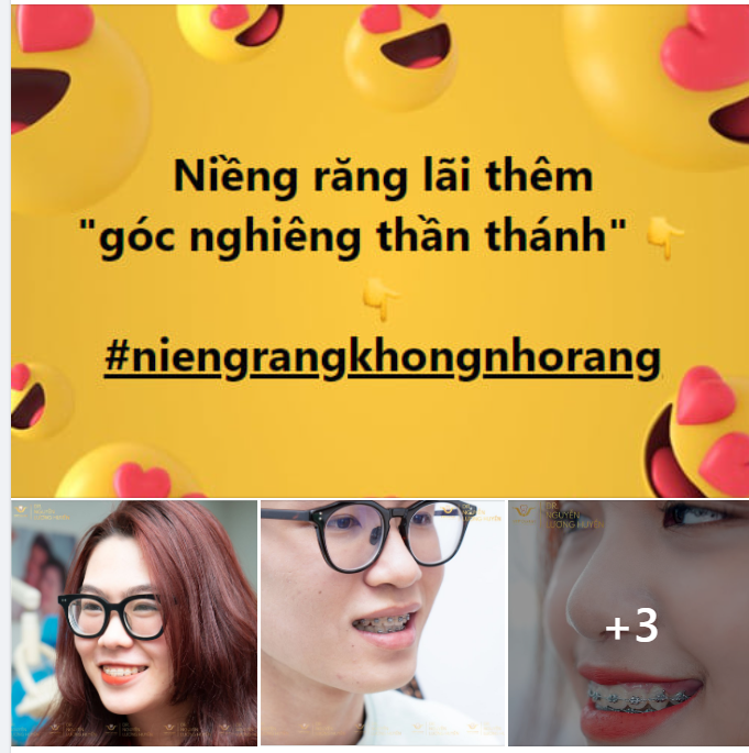 Niềng răng không chỉ thay đổi nụ cười thôi đâu nha!
