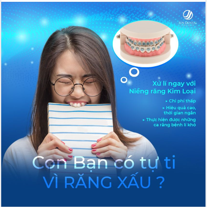 NIỀNG RĂNG MẮC CÀI KIM LOẠI ĐÁNH BẬT NỖI LO CON TỰ TI VÌ RĂNG XẤU