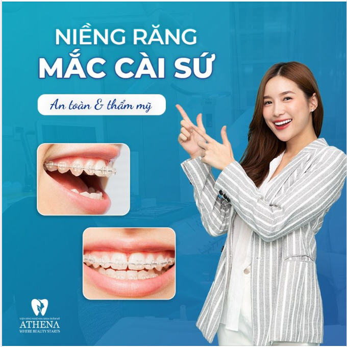 NIỀNG RĂNG MẮC CÀI SỨ - AN TOÀN - THẨM MĨ