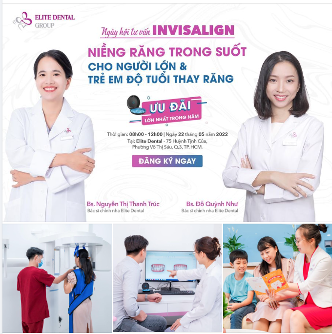 Niềng răng trong suốt cho người lớn và niềng răng trẻ em độ tuổi thay răng