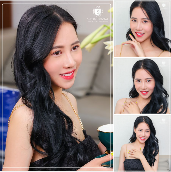 Nụ cười bạn Như Quỳnh - khách hàng thẩm mỹ răng sứ tại Shinbi