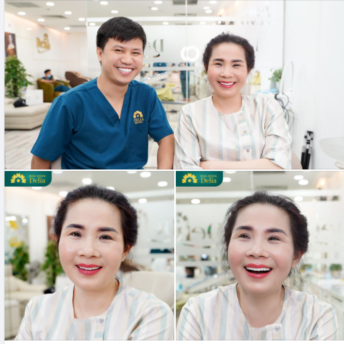 Nụ cười chị Thuý Hương (khách hàng thẩm mỹ răng sứ)