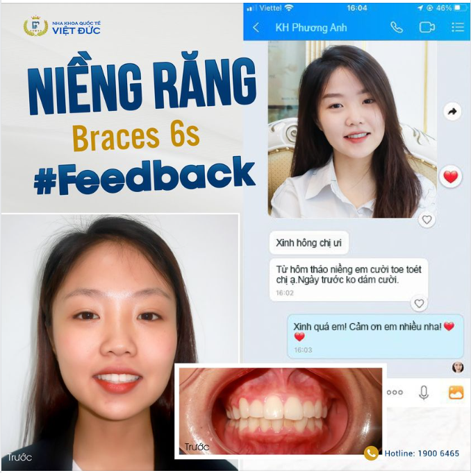 NỤ CƯỜI CỦA BẠN - NIỀM KIÊU HÃNG CỦA CHÚNG TÔI