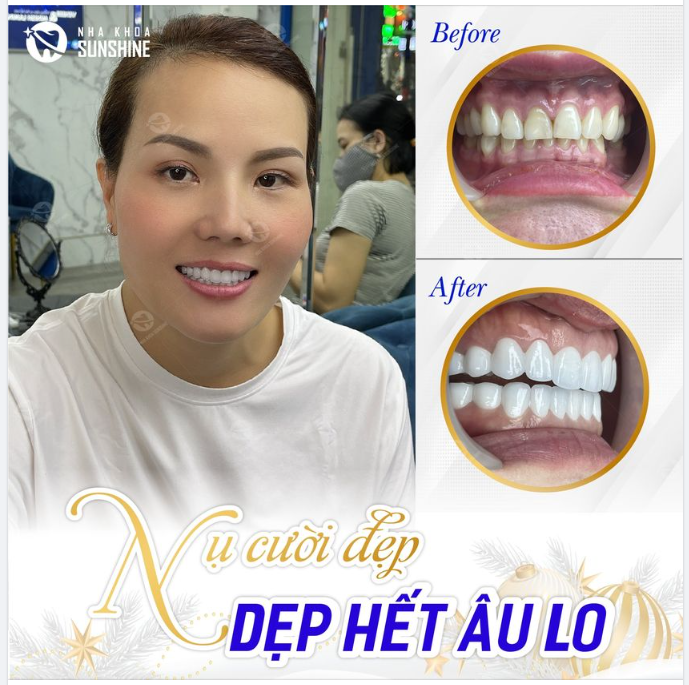NỤ CƯỜI ĐẸP - DẸP HẾT ÂU LO