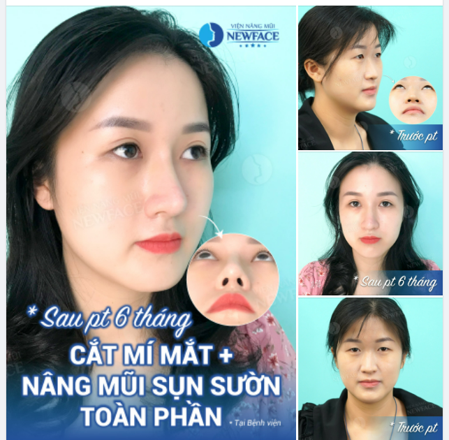 Nụ cười em đánh rơi, anh vô tình nhặt lấy. Kể từ ngày hôm ấy, đêm nào anh cũng sayyy…!
