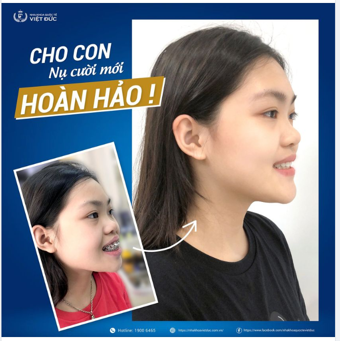 NỤ CƯỜI MỚI HOÀN HẢO - MÓN QUÀ VÔ GIÁ CHO CON