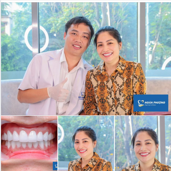 Nụ cười này đáng giá bao nhiêu