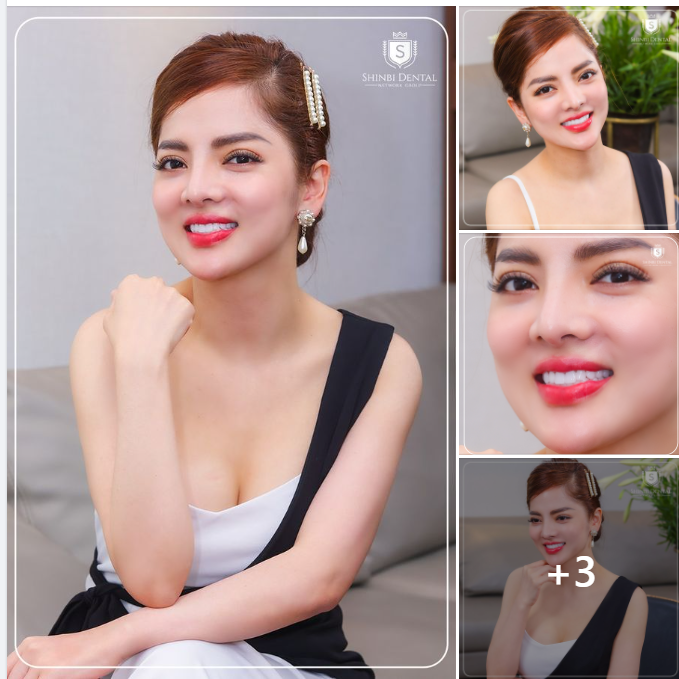 NỤ CƯỜI TỎA NẮNG - SÁNG BỪNG THANH XUÂN