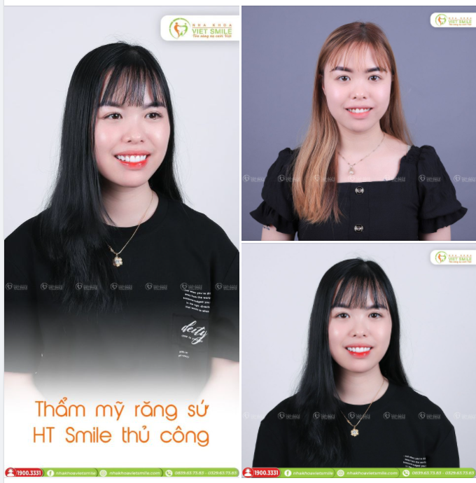 NỤ CƯỜI TỰ TIN SAU THẨM MỸ RĂNG SỨ HT SMILE THỦ CÔNG