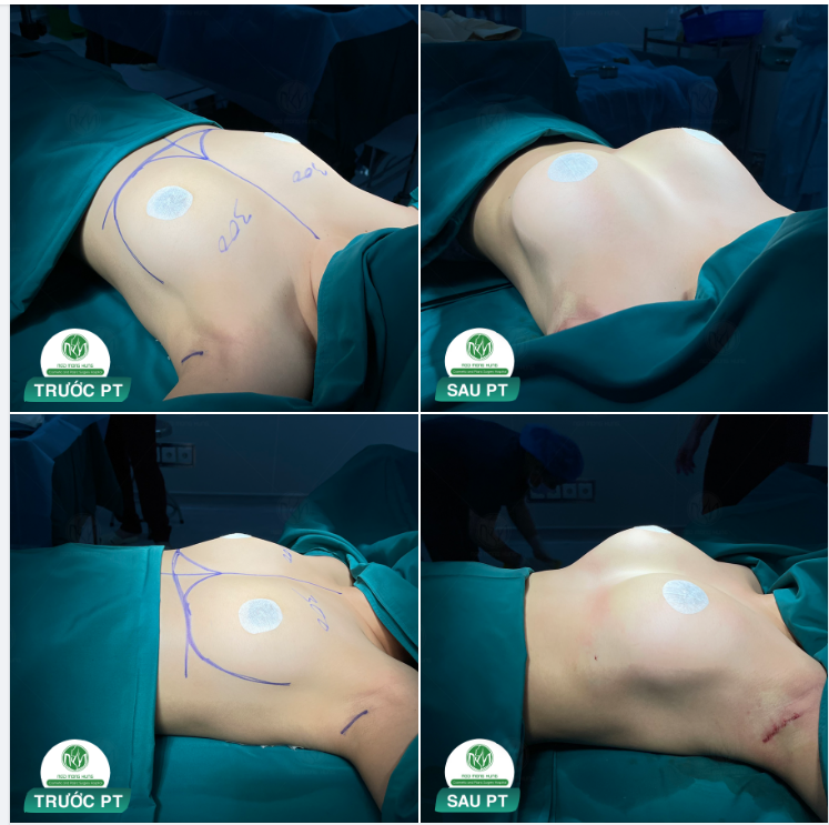Ở ĐÂY CÓ DÁNG NGỰC ĐẸP