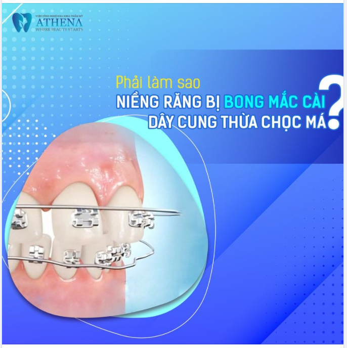PHẢI LÀM SAO NIỀNG RĂNG BỊ BONG MẮC CÀI, DÂY CUNG THỪA CHỌC MÁ?