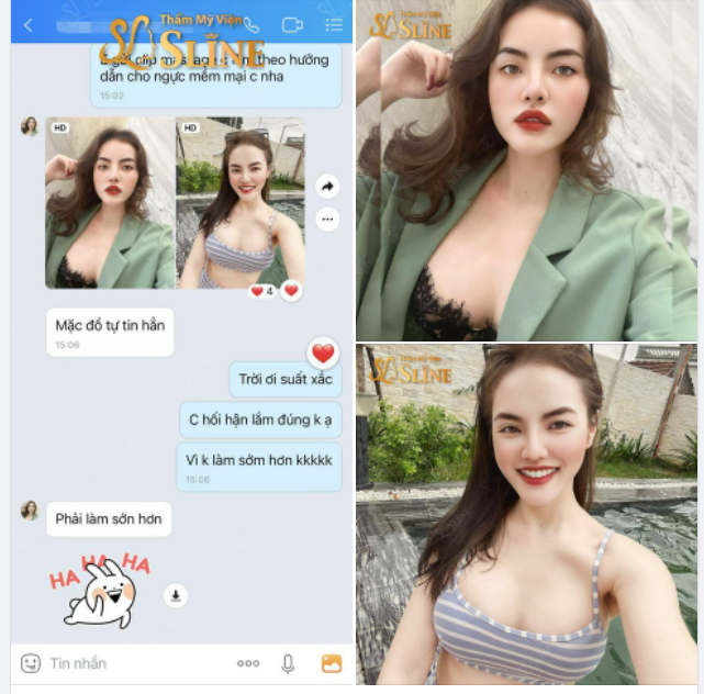 Phải làm sớm hơn khách said. Tâm sự của khách hàng sau khi nâng cấp vòng 1 với ekip Sline