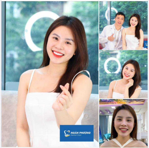 Răng gì mà xinh xinh thế xin thưa rằng răng sứ Nacera