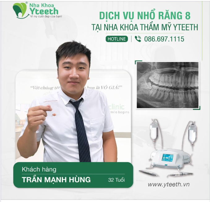 RĂNG KHÔN CÓ CHỊU ĐỢI BẠN HAY KHÔNG?