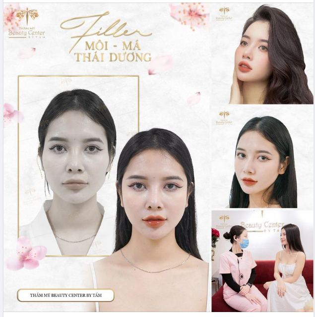 RẠNG RỠ XINH ĐẸP CÙNG FILLER MÁ BABY