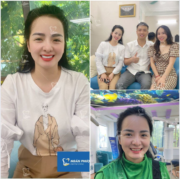 Răng sứ Lava Plus - cho nụ cười nàng đẹp xinh ở mọi vũ trụ