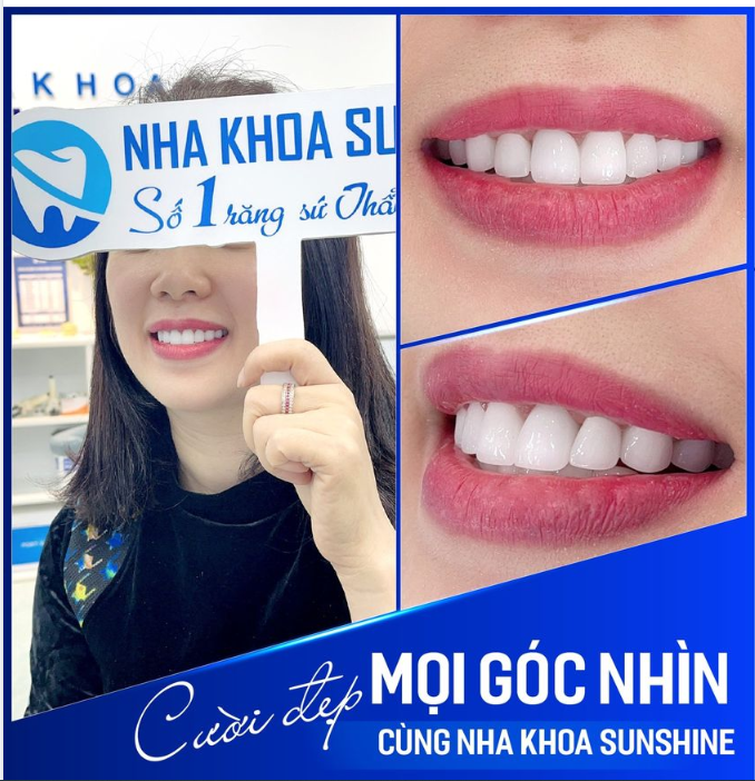 RĂNG SỨ THẨM MỸ - CƯỜI ĐẸP MỌI GÓC NHÌN