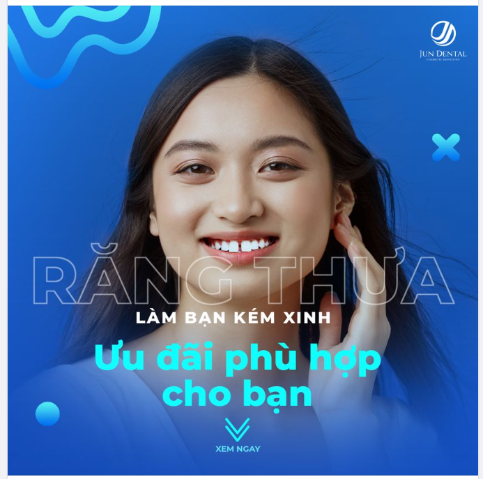 RĂNG THƯA, NIỀNG HAY BỌC?