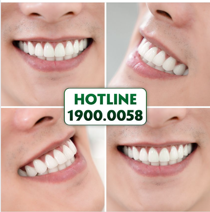 RĂNG TRẮNG TỰ NHIÊN - RẠNG NGỜI KHÍ CHẤT