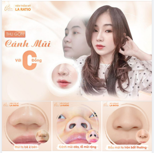 SANG TRANG MŨI TO BÈ VỚI CHI PHÍ 0 ĐỒNG