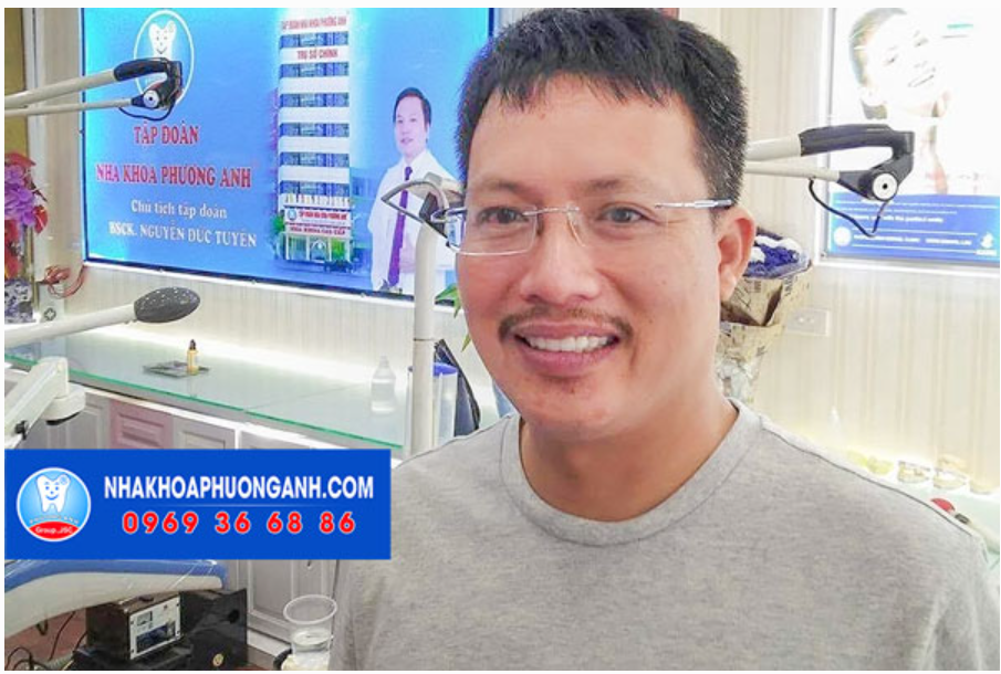 Sau khi phục hình sứ ngoài việc không còn ê buốt khi tiếp sức với thực phẩm và đồ uống, diện mạo cũng được cải thiện nhờ sự thay đổi màu răng trên khuôn mặt