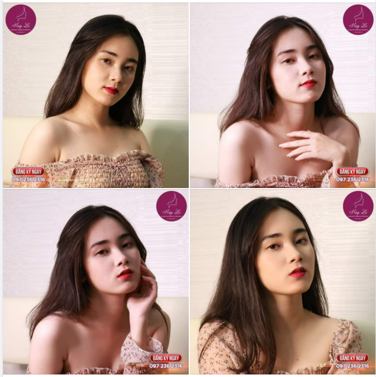 Sở hữu gương mặt 90 độ không góc chết - Tỏa sáng mọi khung hình nhờ dáng Mũi thanh thoát – tự nhiên