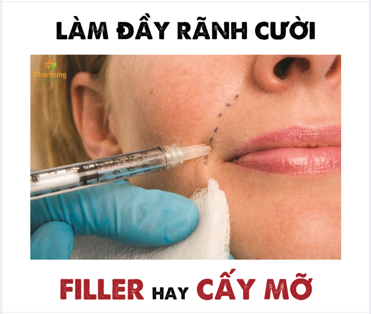 SO SÁNH ĐIỂM KHÁC BIỆT GIỮA CẤY MỠ VÀ TIÊM FILLER RÃNH MŨI MÁ