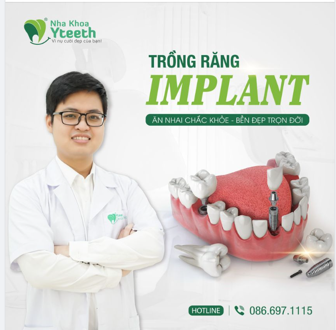 TẠI SAO NÊN LỰA CHỌN PHƯƠNG PHÁP CẤY GHÉP IMPLANT THAY VÌ CÁC PHƯƠNG PHÁP PHỤC HÌNH RĂNG KHÁC?