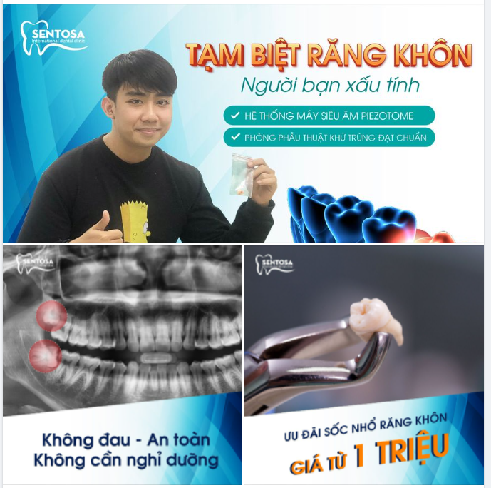 TẠM BIỆT RĂNG KHÔN, NGƯỜI BẠN XẤU TÍNH